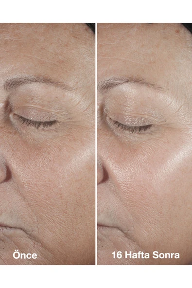 CLİNİQUE Smart Clinical Repair™ Çizgi Ve Kırışıklık Görünümü Karşıtı Serum 50ml | Retinoid, Hyalüronik Asit - Resim 8