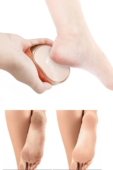 QNİAY Kristal Ayak Topuk Bakım Sert Ölü Cilt Deri Sökücü Ayak Törpüsü Nasır SiliciTörpü Rende Pedikür - 3