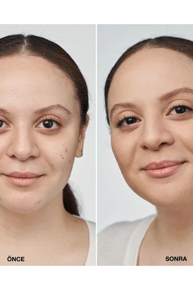 CLİNİQUE Even Better Clinical™ Serum Fondöten Spf 20 - Renk: Cn 52 Neutral (MF) - 30ml - 2