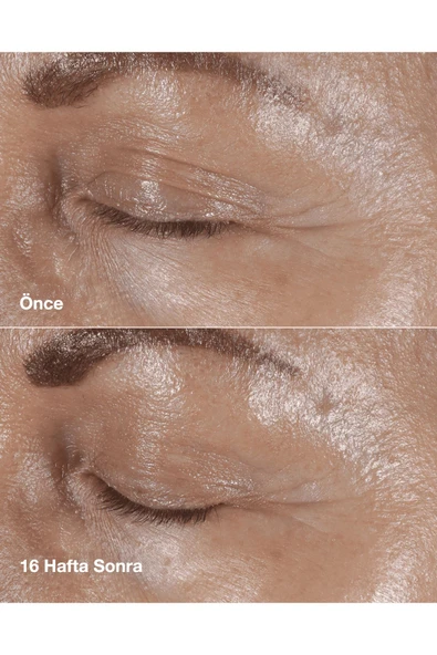 CLİNİQUE Smart Clinical Repair™ Çizgi Ve Kırışıklık Görünümü Karşıtı Göz Kremi 15ml | Hyalüronik Asit, Peptit - 5