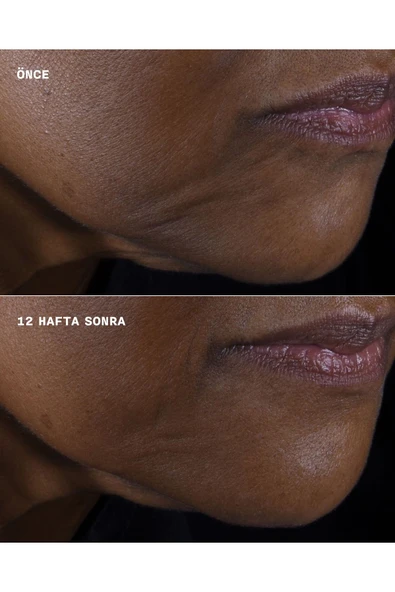 CLİNİQUE Smart Clinical Repair™ Lifting Etkili Yüz Ve Boyun Nemlendirici Krem 50ml | Hyalüronik Asit, Peptit - Resim 6