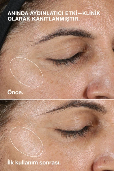 CLİNİQUE Clarifying Lotion (Tip 2) Kuru / Karma Ciltler İçin Arındırıcı Losyon / Tonik 400ml - 3
