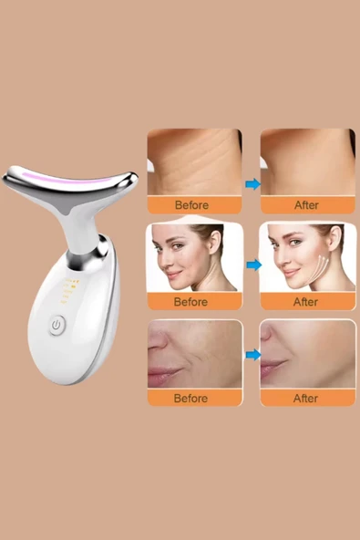 XO Yüz ve Boyun Sıkılaştırıcı Güzellik Cihazı – Kırışıklık, Gıdık ve Sarkma Karşıtı EMS - 7