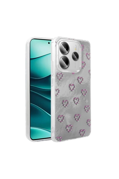 Vipfoni Xiaomi Redmi Note 14 5G Kılıf Kamera Korumalı Figürlü Zore Ponti Silikon Kapak