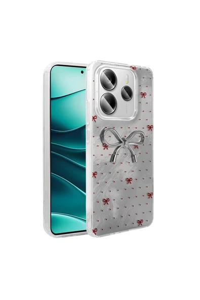 Vipfoni Xiaomi Redmi Note 14 5G Kılıf Kamera Korumalı Figürlü Zore Ponti Silikon Kapak