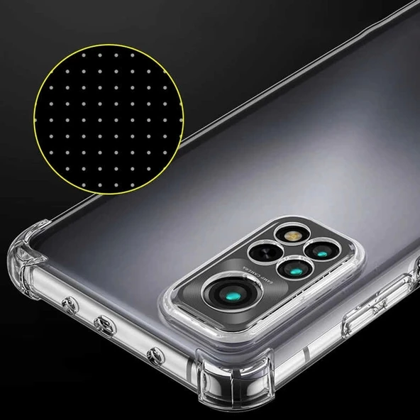 Xiaomi Redmi Note 11 Pro 5G Kılıf Zore Kamera Korumalı Nitro Anti Shock Silikon - Resim 2