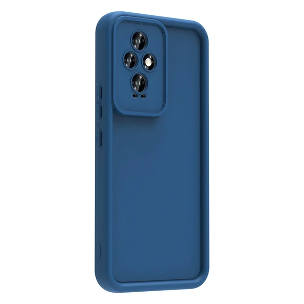 Honor 200 Kılıf Kamera Korumalı Zore Ananas Kapak - 2