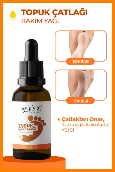 Ayak Ve Topuk Çatlağı Bakım Kokusuz Yağı 30 ml - 4