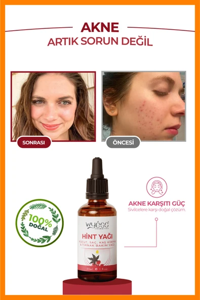 Hint Yağı Vücut, Saç, Kaş Kirpik Ve Tırnak Bakım Yağı, Soğuk Sıkım %100 Saf 30 ml - 4