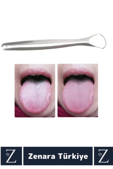 Premium Hijyenik Diş Sağlığını Koruyan Ağız Kokusu Önleyen Paslanmaz Çelik Dil Temizleyici - 2