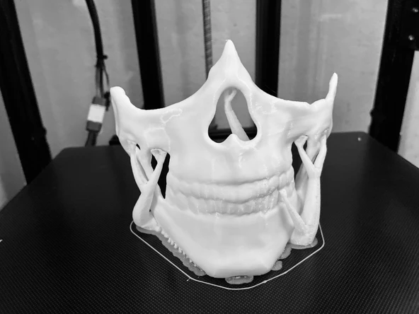 Byr Higgs Maske Dişleri remix (Sadece Plastik Aparattır!!!) 3D - Resim 2