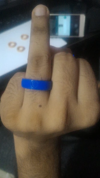 Byr YÜZÜK (Plastik Aparattır!!!) 3D - Resim 4