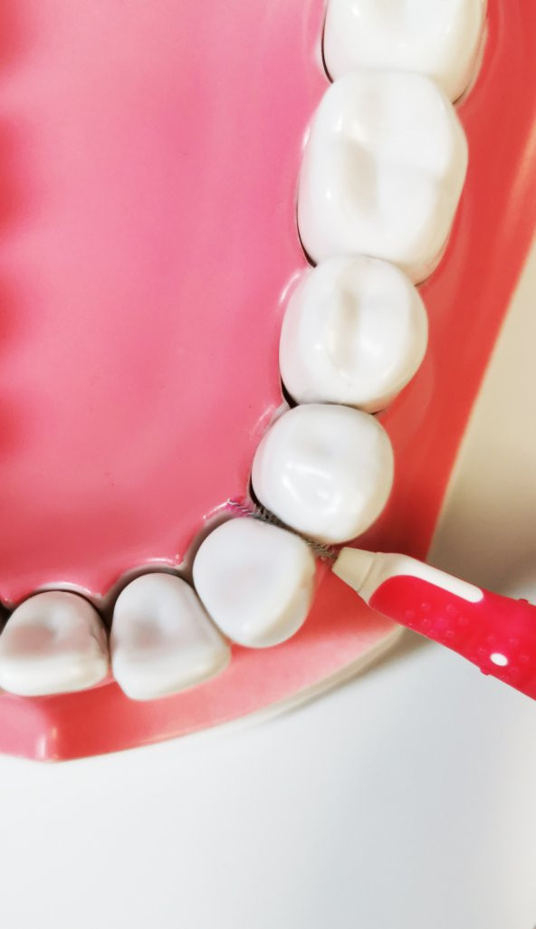 Pearldent ISO 0 Micro - 0.35 mm Kapaklı Arayüz Fırçası 6 Lı - 4