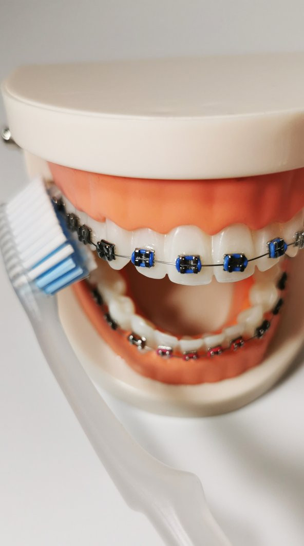 Pearldent Ortho - Ortodontik Diş Fırçası (Kapaklı) - 3