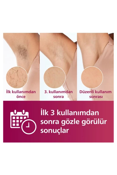 Philips Lumea Brı950/00 Ipl Epilatör - 4