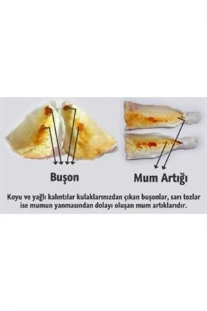 Trade Bazaar Doğal Kulak Temizleme Mumu 2 Adet - 4