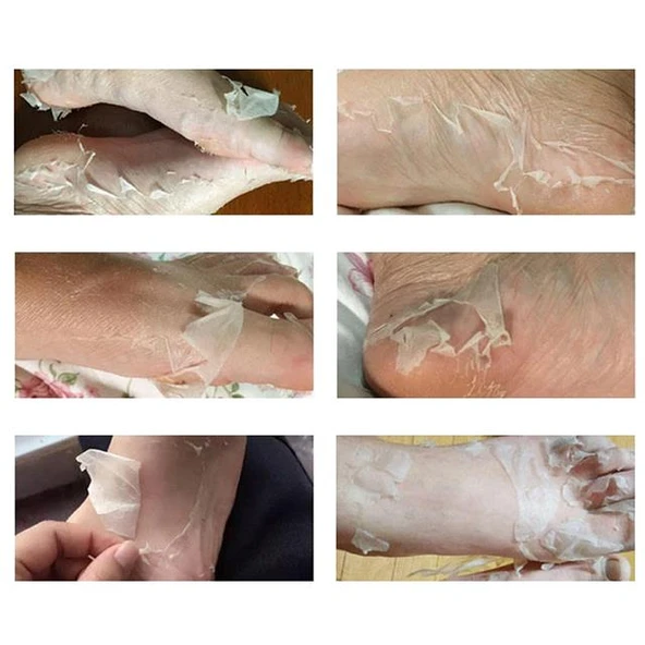 Sunup SN-26965 Ayak Peeling Maskesi (Nasır, Ölü Deri, Egzama Giderici) - 4