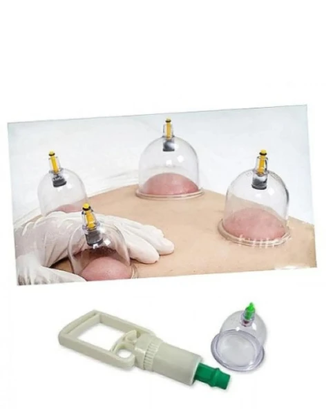 Hacamat Seti - Vakumlu Kupa Çekme Seti (Model 1) (483483) - 2