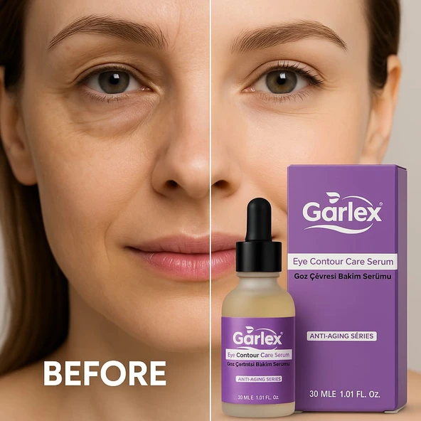 Garlex yaşlanma karşıtı göz çevresi bakım serumu,30 ml - 2