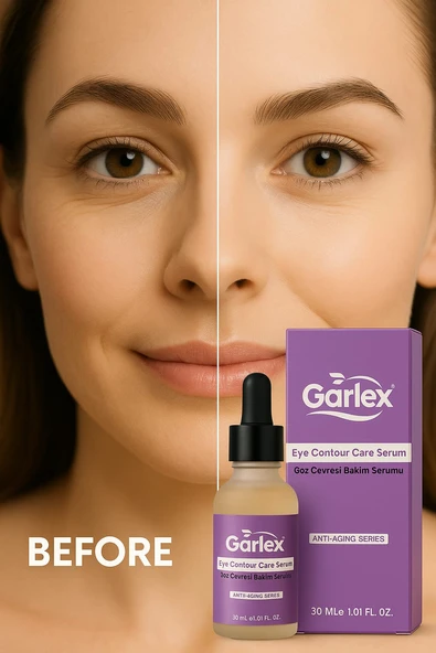 Garlex yaşlanma karşıtı göz çevresi bakım serumu,30 ml - 3