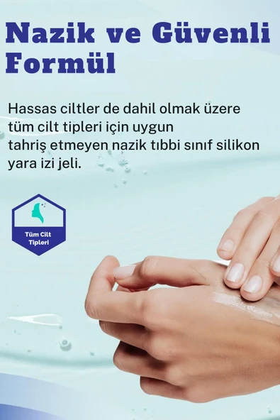 Silikon Yara Jeli  Keloid, Ameliyat, Yanık Ve Yaralanma Izleri Için Tıbbi Kalitede Jel - 5