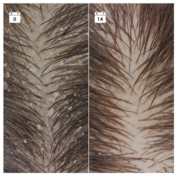 SEPHORA COLLECTION Kepek Karşıtı Nüks Önleyici Serum - Saç Serumu - 2