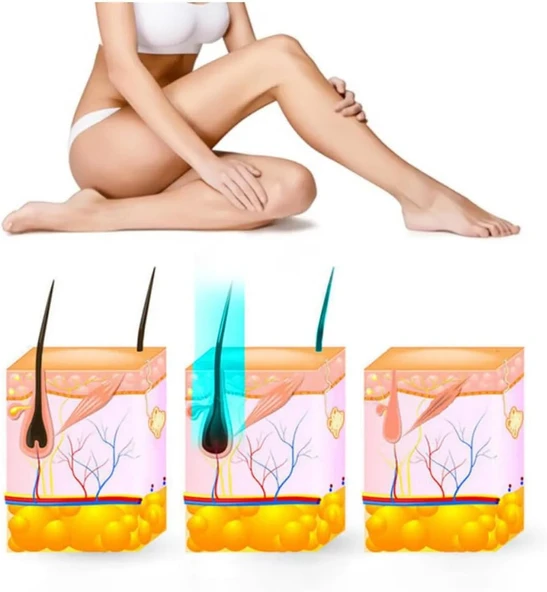 Yui IPLV15 Pro Vücut -Yüz- Bikini Başlıklı Ağrısız Otomatik ve Manuel Atım Buz Lazer Epilasyon Cihazı - 3