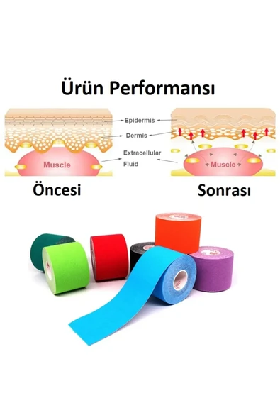 Acura Ac-150 Yüz & Vücut Uyumlu Hipoalerjenik Kinesyo Tape Ağrı Bandı 5m X 5cm- - 3