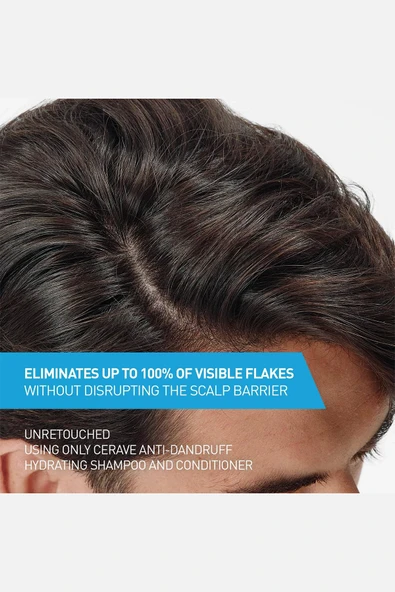 CeraVe Kepeğe Karşı Nemlendirici Şampuan 355ML - 4