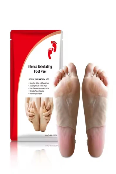 Ayak Peeling Maskesi – Nasır, Ölü Deri, Giderici, Nemlendirici Lavanta Özlü Maske - 4