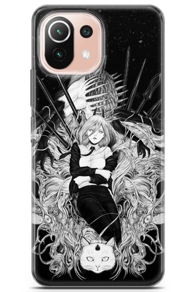 Uvilda Xiaomi Mi 11 Lite Uyumlu Manga 23 Uv Kapak Anime Kadın Ve Kedi - 1