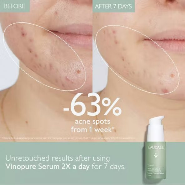 Caudalie Vinopure Serum 30 ml - 2