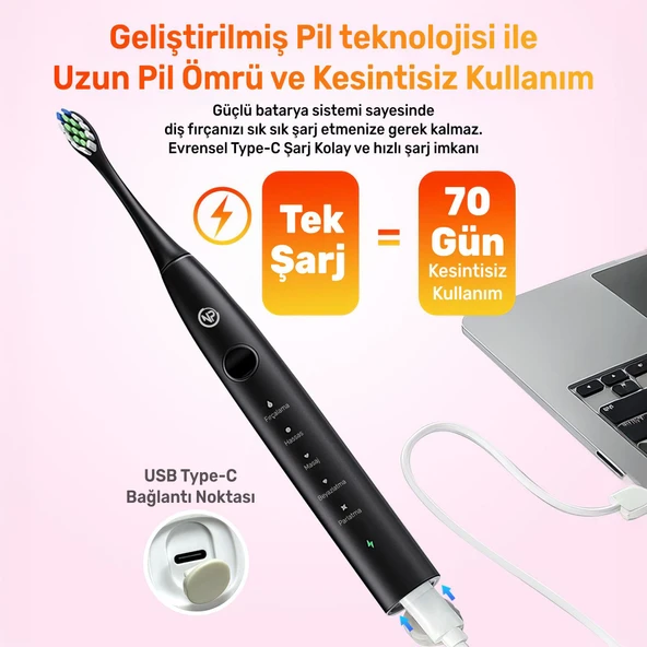 NPO Nicefeel X610-Z Dakikada 40000 Titreşim, Şarjlı Sonic Profesyonel Diş Fırçası-Siyah - 2
