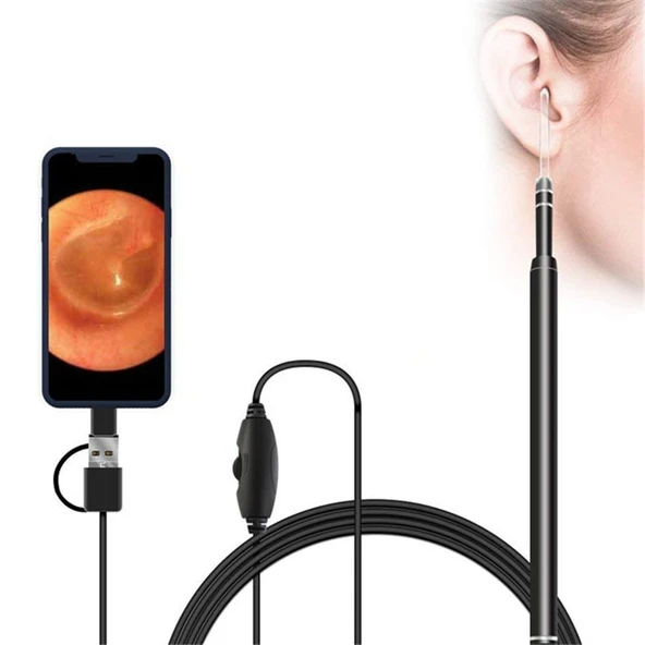 3 in 1 USB HD Dijital Muayene Otoskop Kulak Tipi Dijital Endoskop Kulak Kiri Temizleyici