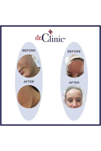 DR. CLİNİC VİTAMİN C NEMLENDİRİCİ CİLT KREMİ (50 ML) - 5
