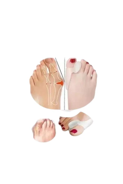 APS Ayak Baş Parmak Koruyucu Silikon Makaralı Bunyon Yüksek Kalite Halluks Valgus Makarası - 2