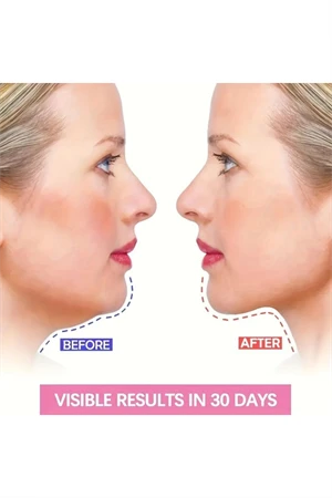 Ayarlanabilir V-Şekilli Yüz Kaldırma Bandı (Unisex) – Çift Çene Azaltıcı, Nazolabiyal Kırışıklık Sıkılaştırıcı, Nefes Alabilen & Kokusuz, Hipoalerjenik Kumaş, - Resim 2