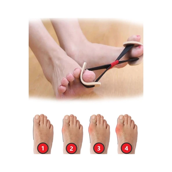 Ayak Baş Parmak Kemik Düzeltici Egzersiz Lastiği - 3