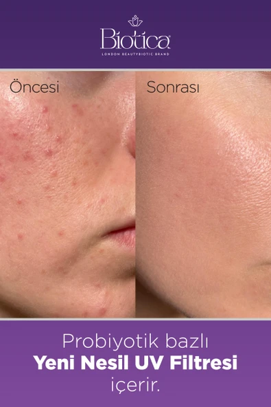 Biotica Microbiotic Acne Treatment Face-up Serum 20 ml - 3