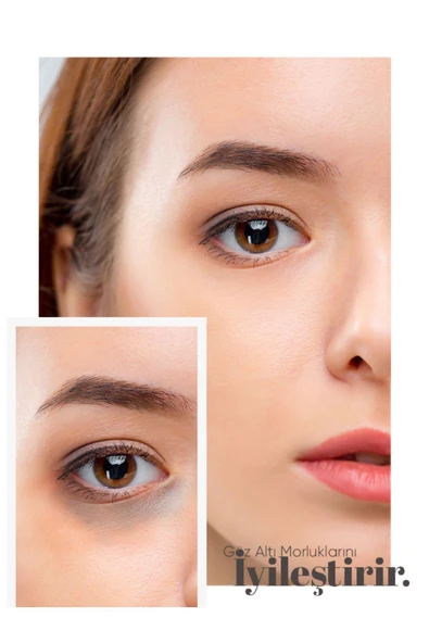 WİNLİFE KOLAJEN GÖZ ÇEVRESİ KREMİ - 2
