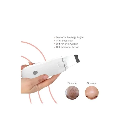 Ultrasonik Spatula Yüz Akne Giderici Siyah Nokta Temizleme Cihazı - 3