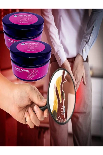 Hacı Anne Hemeroid Sızıları Şişliği Azaltıcı Ağrı Ve Masaj Kremi 250 ml - 2