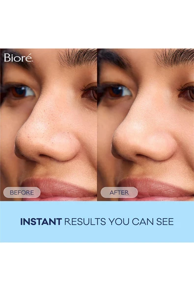 Biore The Original Gözenek Temizleme Bandı 8 Adet - 5