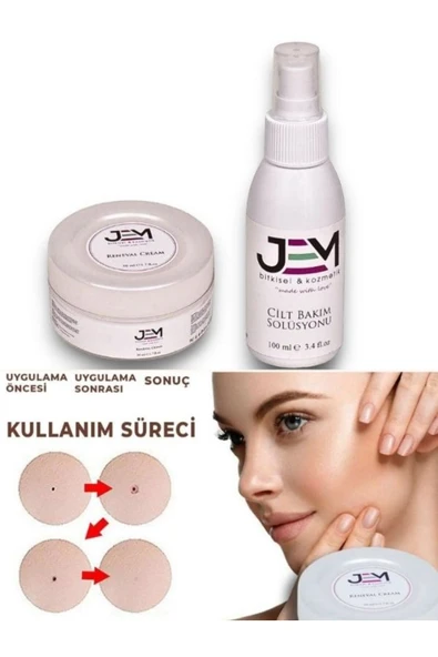 Jem Kozmetik Bitkisel Renewal Cream Wart Set - 1