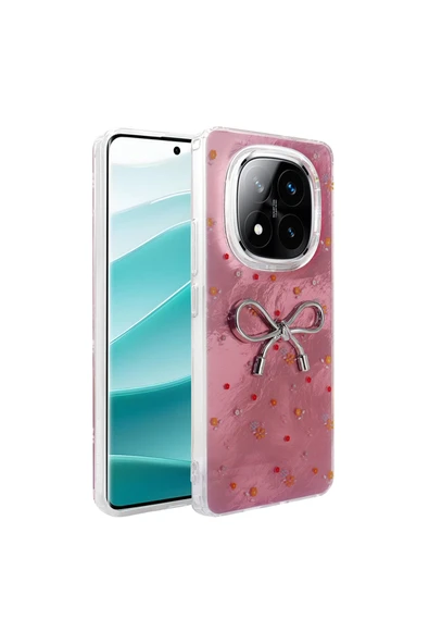 KILIFTECH Redmi Note 14 Pro Plus Kılıf Kamera Korumalı Figürlü Zore Ponti Silikon Kapak - Lila - Resim 2