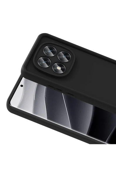 KILIFTECH Redmi Note 14 Pro Plus Kılıf Kamera Korumalı KTH Ananas Kapak - Pembe - Resim 8