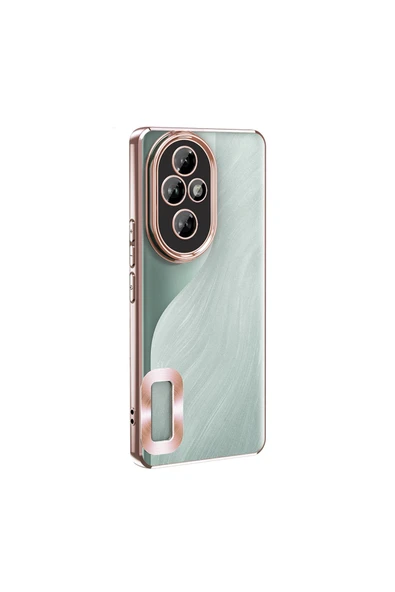 KILIFTECH Honor 200 Pro Kılıf Kamera Korumalı Logo Gösteren Zore Omega Kapak - Gold - 5