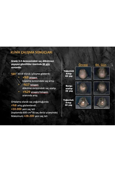 MORGAN'S POMADE Hair Growth Volume Spray - Dökülme Karşıtı Yenileyici Sprey 120 ml - Resim 4