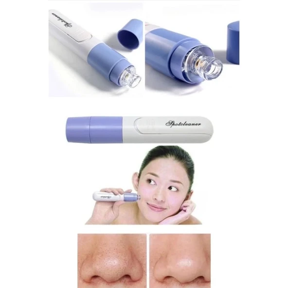Pore Cleaner Vakumlu Yüz Temizleme Siyah Nokta Temizleme Cihazı - 3