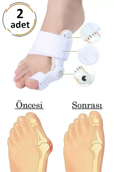 Mucit Home Atel Ayak Parmak Başparmak Düzeltici Kemik Çıkığı Düzleştirici Taraklı Ayaklar Için Aparat 2'li - 8